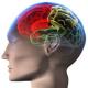 Traumatic brain injury - effects