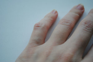 join protect calivita articulație pe mână unde doare degetul mare