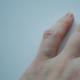 Češeri na prstima: uzroci i liječenje